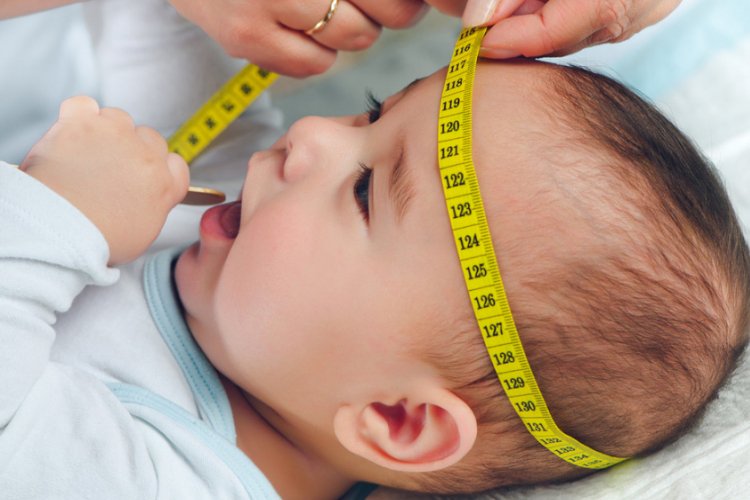 bebeklerde oluşan kafa yamukluğu i̇çin hangi bölüme gidilir